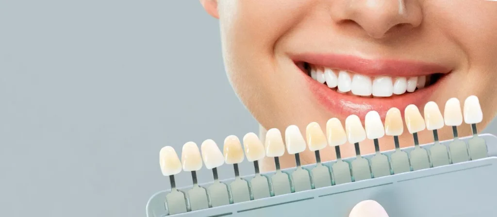 Cosmetic Dentistry Chandler AZ